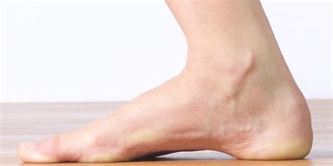 High Arches Problems: How to Relieve Foot Arch Pain - Tread Labs