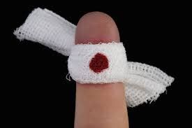 How to stop bleeding for cuts and wounds – WowMom.co.ke