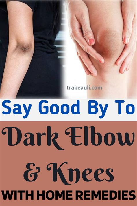 How To Get Rid Of Dark Elbows Overnight At Home | Trabeauli | Dark elbows, How to get rid of ...