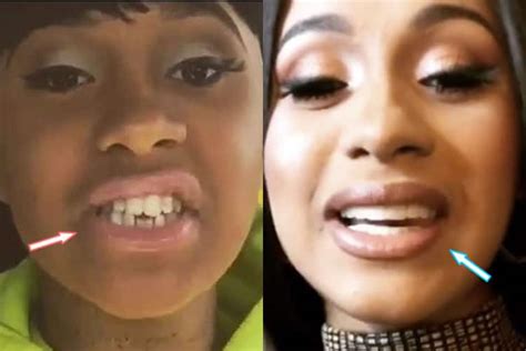 Cardi B Plastic Surgery REVEALED! (Before & After Photos 2021)