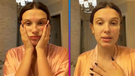 Millie Bobby Brown Opens Up About Her Acne in New Makeup-Free Video