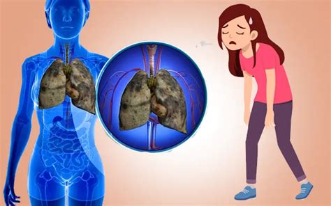 5 Signs Your Lungs Are Gasping for Help – Page 5 – Widely