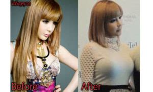 Park Bom Plastic Surgery, Before and After Nose, Eyelid Surgery Pictures