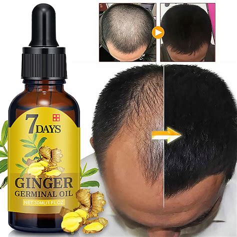 Upgraded 7 Days Ginger Germinal Oil Hair Regrowth Serum Hairdressing ...