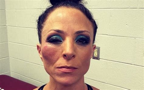 PHOTO: Serena Deeb Shows Off Battle Scars After AEW Dynamite Street ...