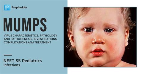 Mumps : Virus Characteristics, Pathology and Pathogenesis ...