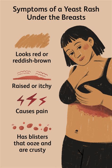 11 Home Remedies To Get Rid Of Rashes Under The Breast | atelier-yuwa ...