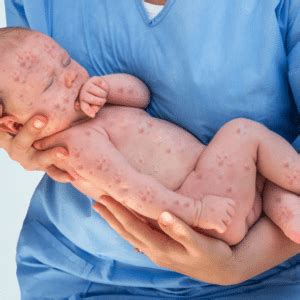 Congenital Anomalies: The Major Causes and What Can Be Done