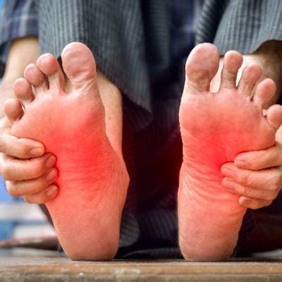 Erythromelalgia in the Feet | Podiatrist In Aloha, OR | David Chung, DPM