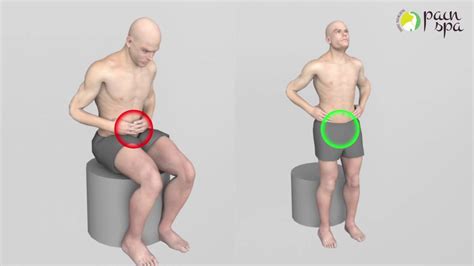 Pupendal Neuralgia & Pudendal Nerve Block by Dr M Krishna - YouTube