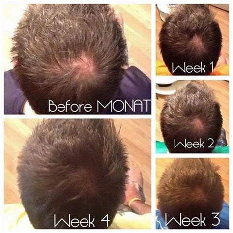 Monat clinically proven to stimulate hair growth. lorrainef.mymonat.com ...