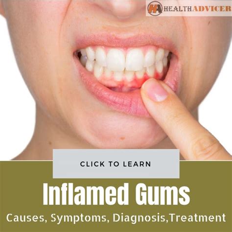 Inflamed Gums: Causes, Symptoms, Diagnosis And Treatment