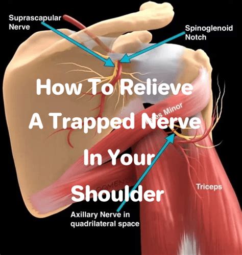 How to Relieve a Trapped Nerve in Your Shoulder (2022)