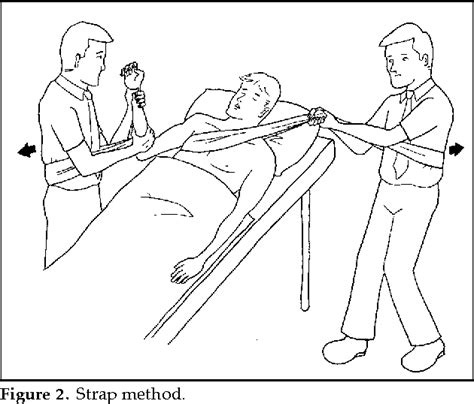 Figure 1 from Closed Reduction Techniques for Acute Anterior Shoulder Dislocation: from ...