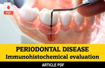 PDF: Immunohistochemical evaluation of the inflammatory response in periodontal disease