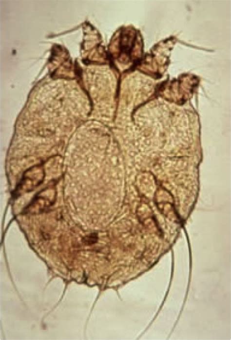 Sarcoptes scabiei (the itch mite) is a parasitic arthropod that burrows ...