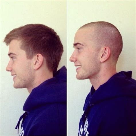 Balding Buzz Cut Before And After