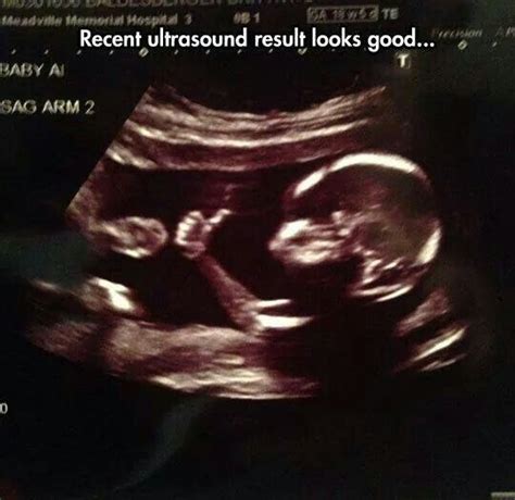 Pin by Rachel Bigelow on Funny stuff | Ultrasound, Funny pictures ...