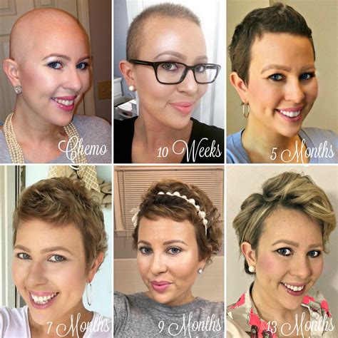 Do You Always Lose Your Hair With Chemo For Breast Cancer - Semi Short Haircuts for Men