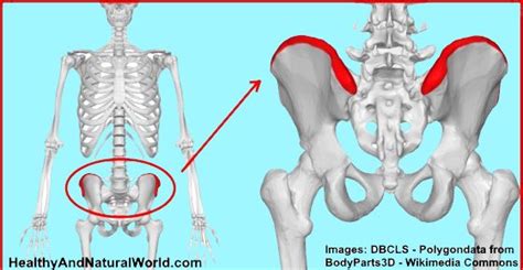 Iliac Crest Pain: Causes and Home Remedies