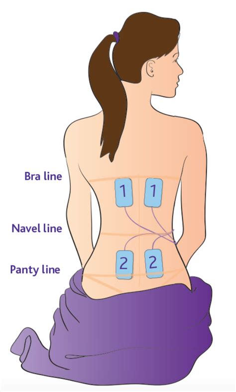 TENS Machine Use - THAMES VALLEY MIDWIVES