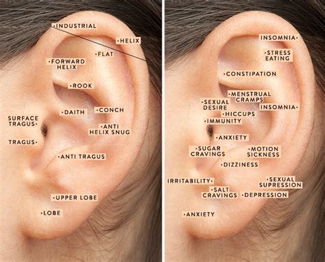 Weight Loss Printable Ear Seed Placement Chart