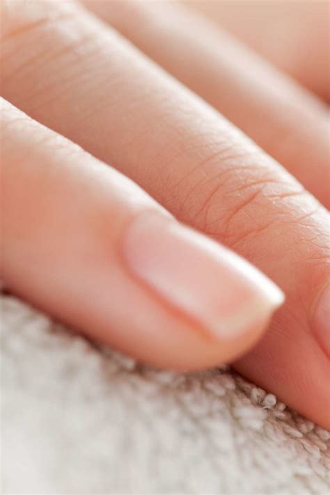 Peeling nails: Causes, treatment, and prevention