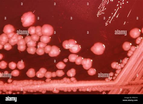 Proteus -bacterium- - sanyra