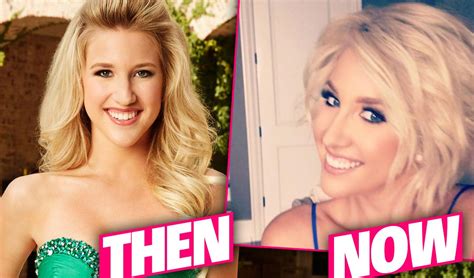 Todd Chrisley Teen Daughter Savannah’s Plastic Surgery Exposed By Top Docs