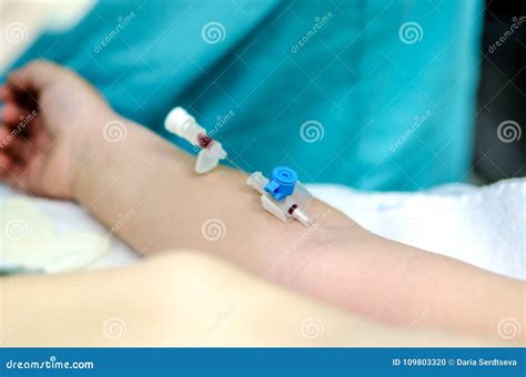 Cathéter Veineux Périphérique Pour L'infusion Intraveineuse Photo stock - Image du docteur ...