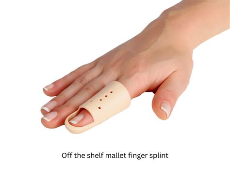 Mallet Finger | Perfect Therapy