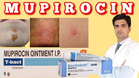 T bact ointment | Bactroban ointment | Mupirocin ointment uses, side effects, how to apply - YouTube