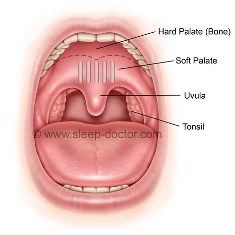 Anterior Tonsillar Pillar