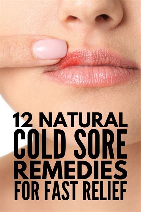 Fast and Effective: 12 Natural Cold Sore Remedies that Work - medicine health life