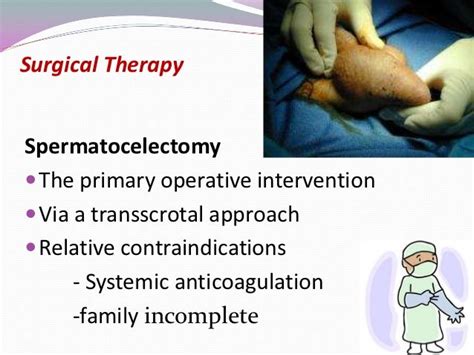 Spermatocoele