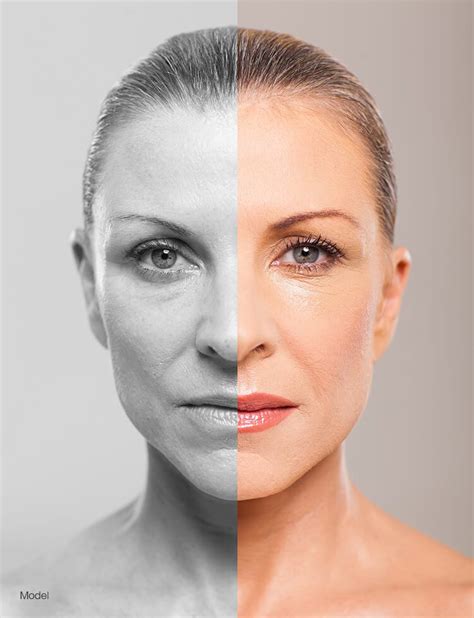 Is Facial Plastic Surgery Permanent? | North Shore Aesthetics