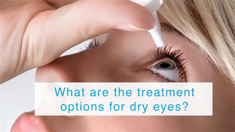 What are the treatment options for dry eyes? - YouTube