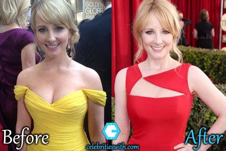 Melissa Rauch Boob Job, Breast Reduction, Before and After Pictures - CelebritiesWith.com