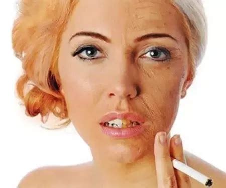 How to Prevent Aging Face - DHealthWellness - Everything About Health ...