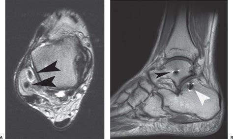 The Foot and Ankle | Radiology Key