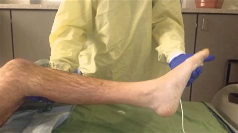 Ankle clonus - YouTube