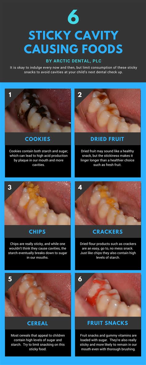 6 Sticky Cavity Causing Foods [Infographic] | Arctic Dental