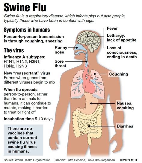 Prevention and home remedies of Swine Flu (H1N1)