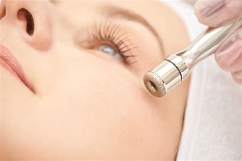 Microdermabrasion Cost: Treatments Needed, Insurance & Alternatives