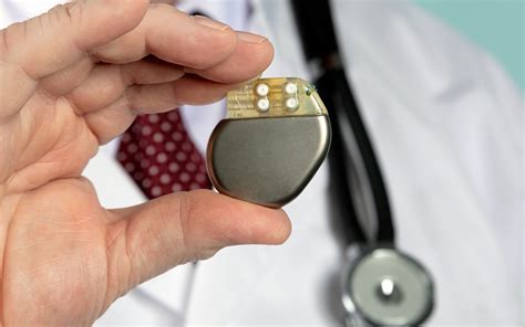 Pacemaker Surgery: Recovery, Side Effects & Precautions