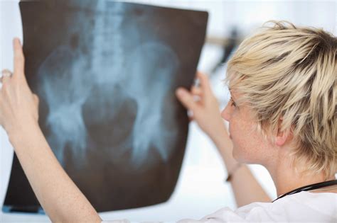 Stryker Defective Hip Led to Complications, Lawsuit Says - Top Class ...