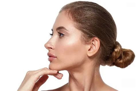 Everything You Need to Know Before Getting a Chin Implant Surgery