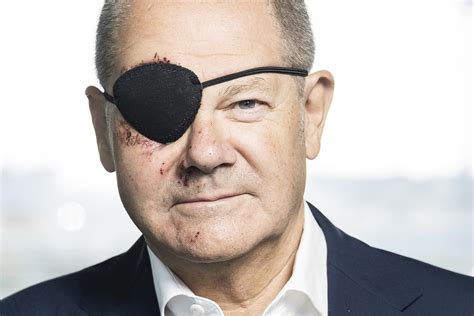 German Chancellor Olaf Scholz black eye patch