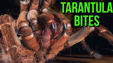 TARANTULA BITE: First Aid, Symptoms & Prevention - YouTube