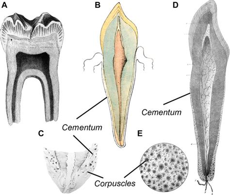 Figure 5 from On the discovery of cementum. - Semantic Scholar